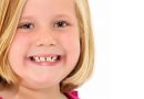 すきっ歯の女の子