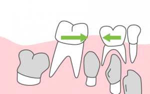 乳歯　