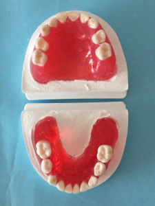乳歯模型